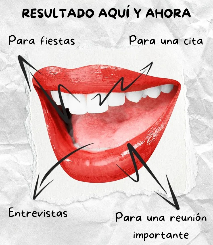 Blanqueador V34 Glumident