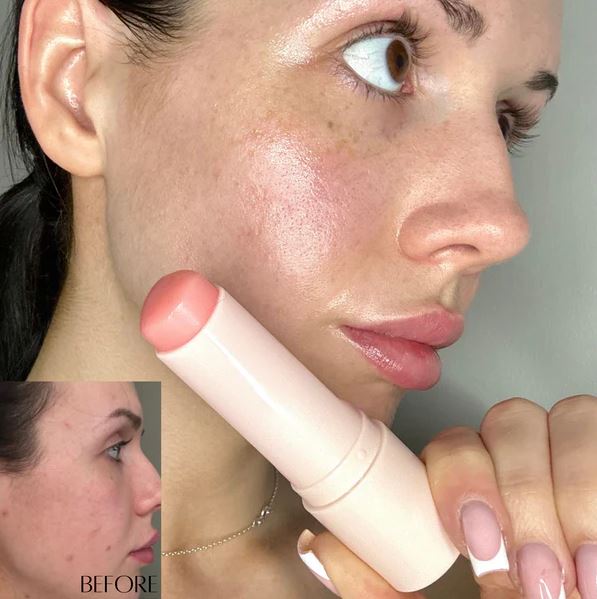 Bálsamo de Colágeno ANTIARRUGAS (1+1 GRATIS)