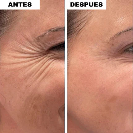 Bálsamo de Colágeno ANTIARRUGAS (1+1 GRATIS)